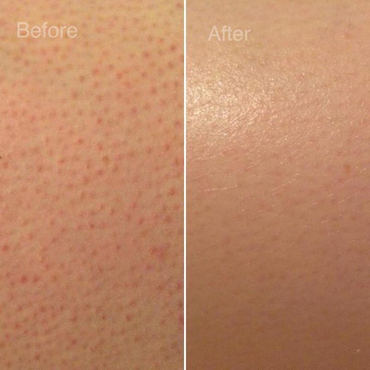 Arabica Coffee Scrub Bar